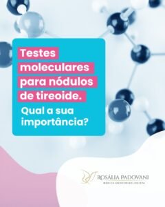 Leia mais sobre o artigo Testes moleculares para nódulos de tireoide. Qual a sua importância ?