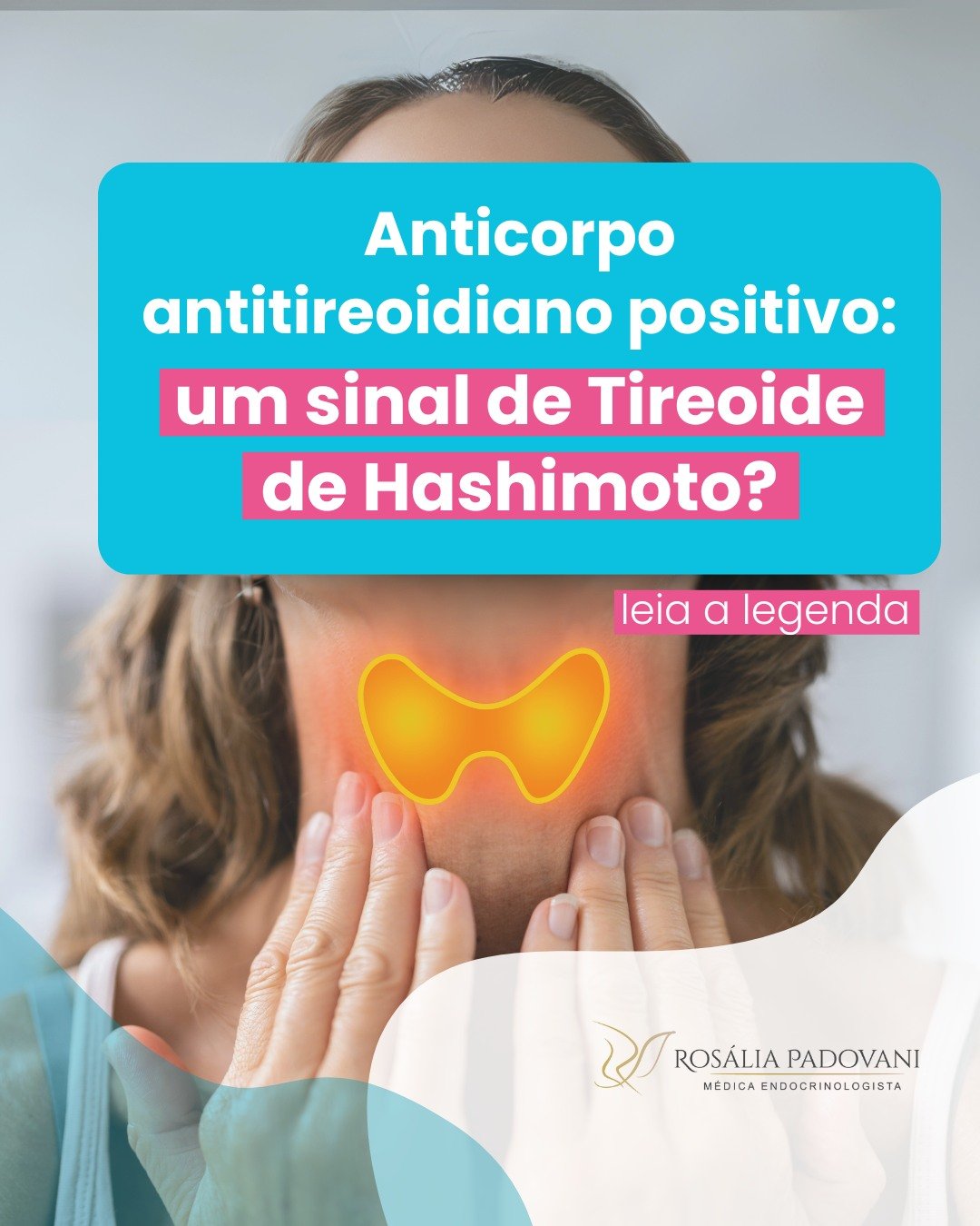 Leia mais sobre o artigo Anticorpo antitireoidiano positivo: Um sinal de Tireoide de Hashimoto?