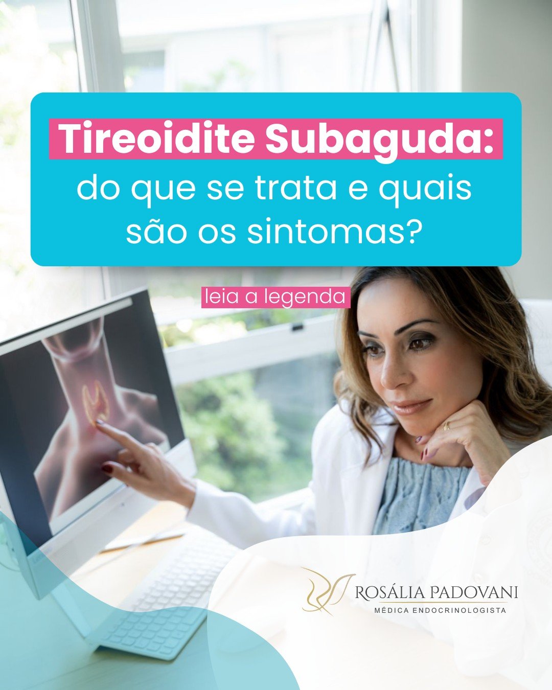 Leia mais sobre o artigo Tireoidite Subaguda: do que se trata, quais os sintomas e qual é o tratamento?
