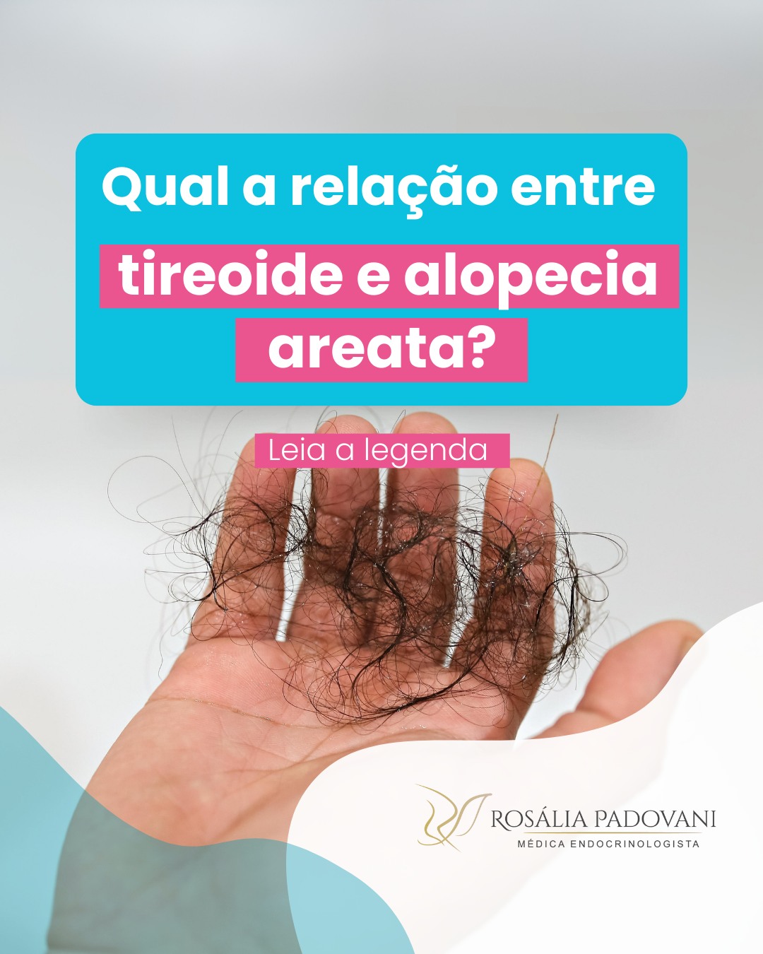 Você está visualizando atualmente Qual a relação entre tireoide e alopecia areata?