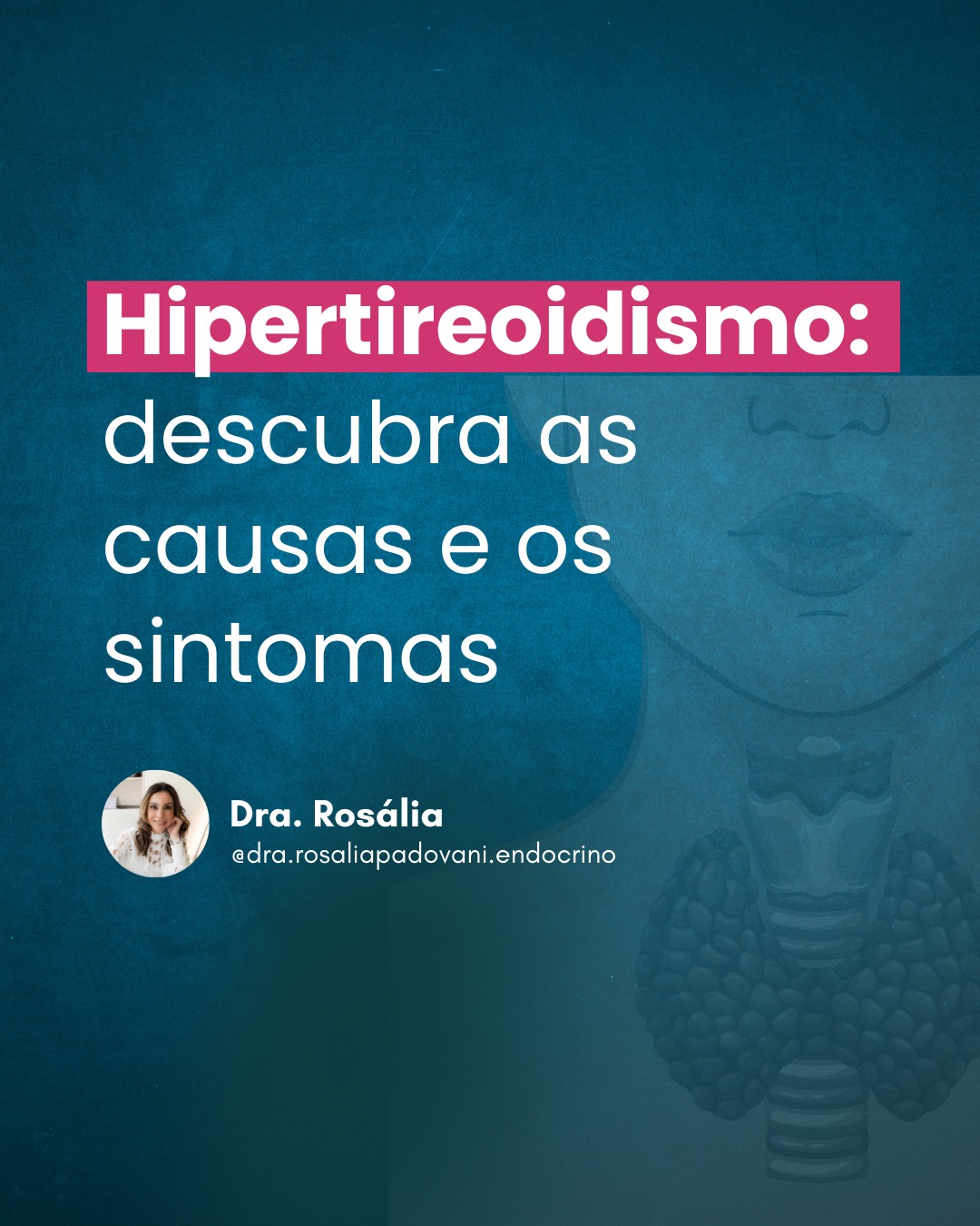 Leia mais sobre o artigo Hipertireoidismo: descubra as causas e os sintomas