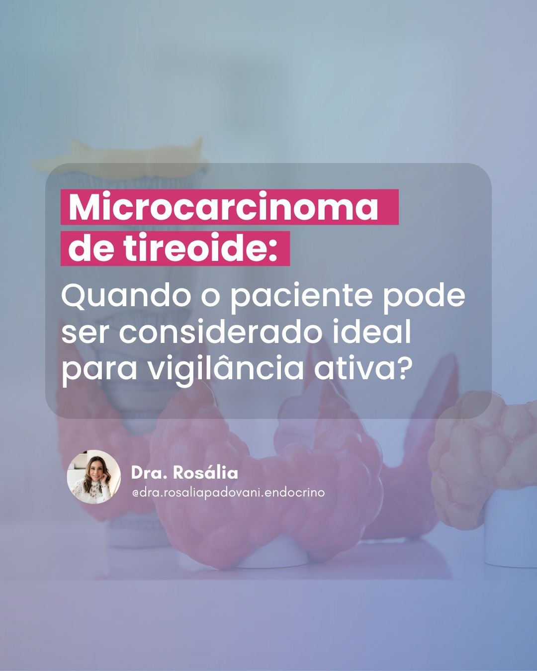 Leia mais sobre o artigo Micro carcinoma de tireoide: Quando o paciente pode ser considerado ideal para vigilância ativa?