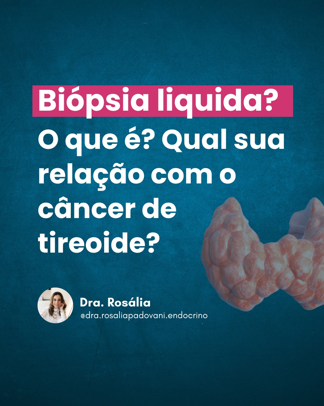 Leia mais sobre o artigo Biópsia liquida? O que é? Qual sua relação com o câncer de tireoide?