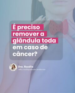 Leia mais sobre o artigo É preciso remover a glândula toda em caso de câncer?