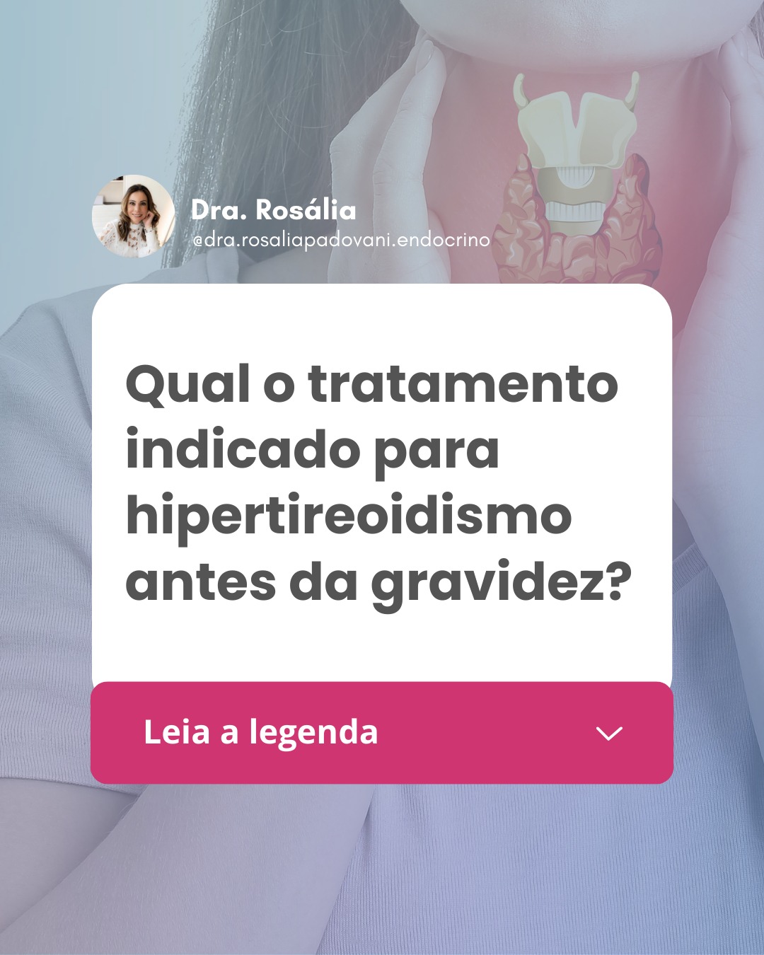 Leia mais sobre o artigo Qual o tratamento indicado para hipertireoidismo antes da gravidez?
