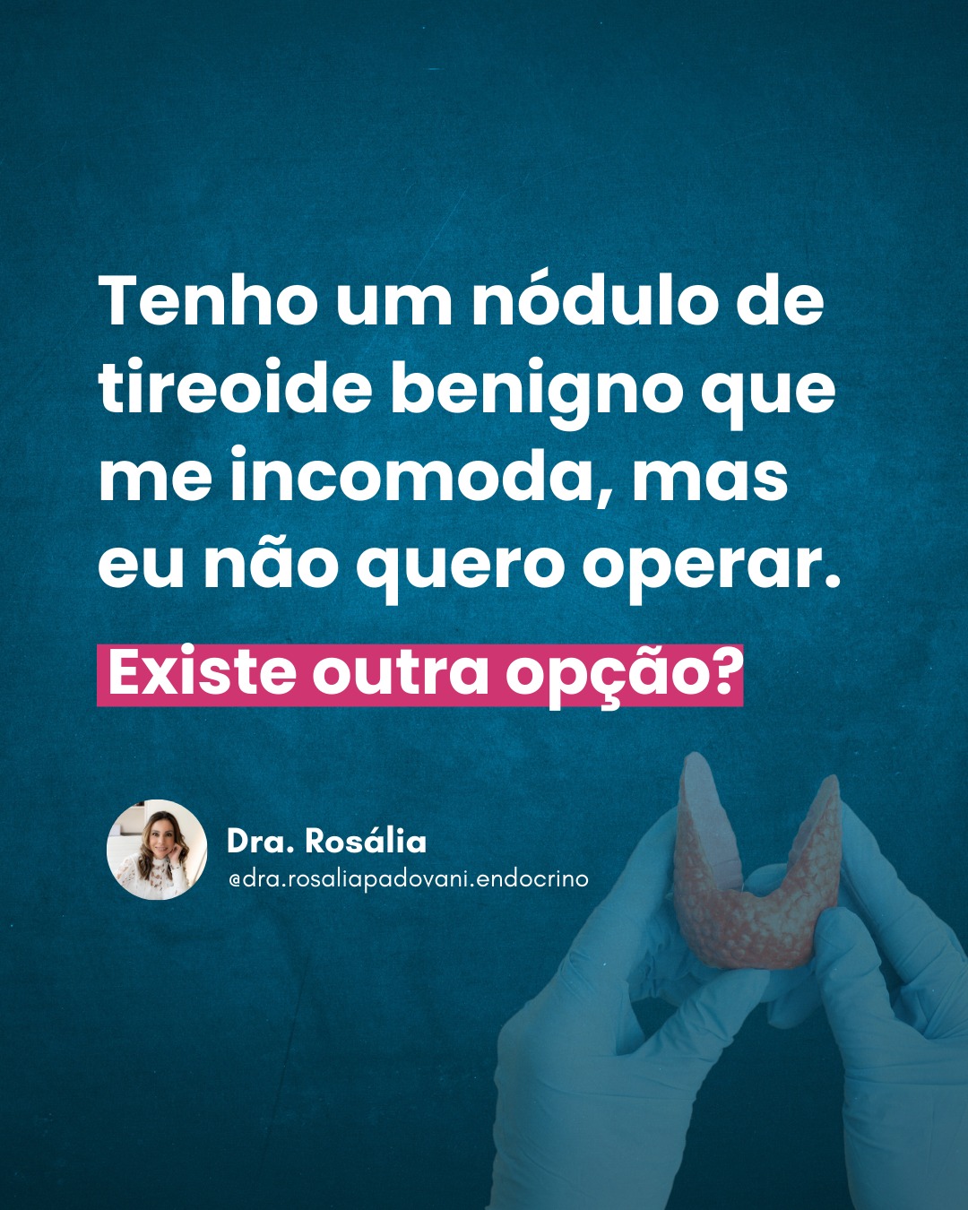 Leia mais sobre o artigo Tenho um nódulo de tireoide benigno que me incomoda, mas eu não quero operar. Existe outra opção?