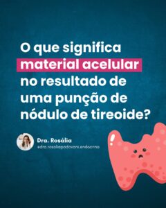 Leia mais sobre o artigo O que significa material acelular no resultado de uma punção de nódulo de tireoide?