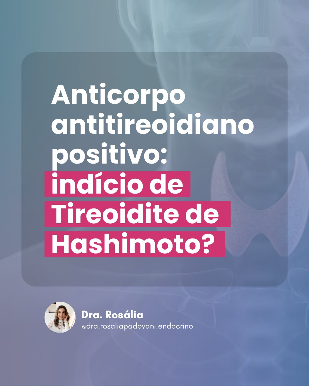 Leia mais sobre o artigo Anticorpo antitireoidiano positivo: Indício de Tireoide de Hashimoto?