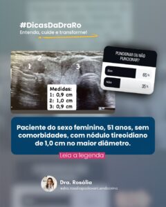 Leia mais sobre o artigo O nódulo em questão é sólido e hipoecoico