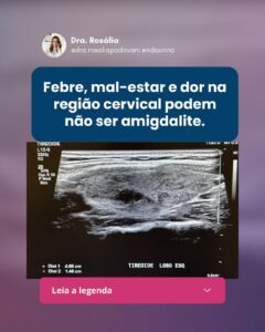 Leia mais sobre o artigo Febre, mal-estar e dor na região cervical podem não ser amigdalite.