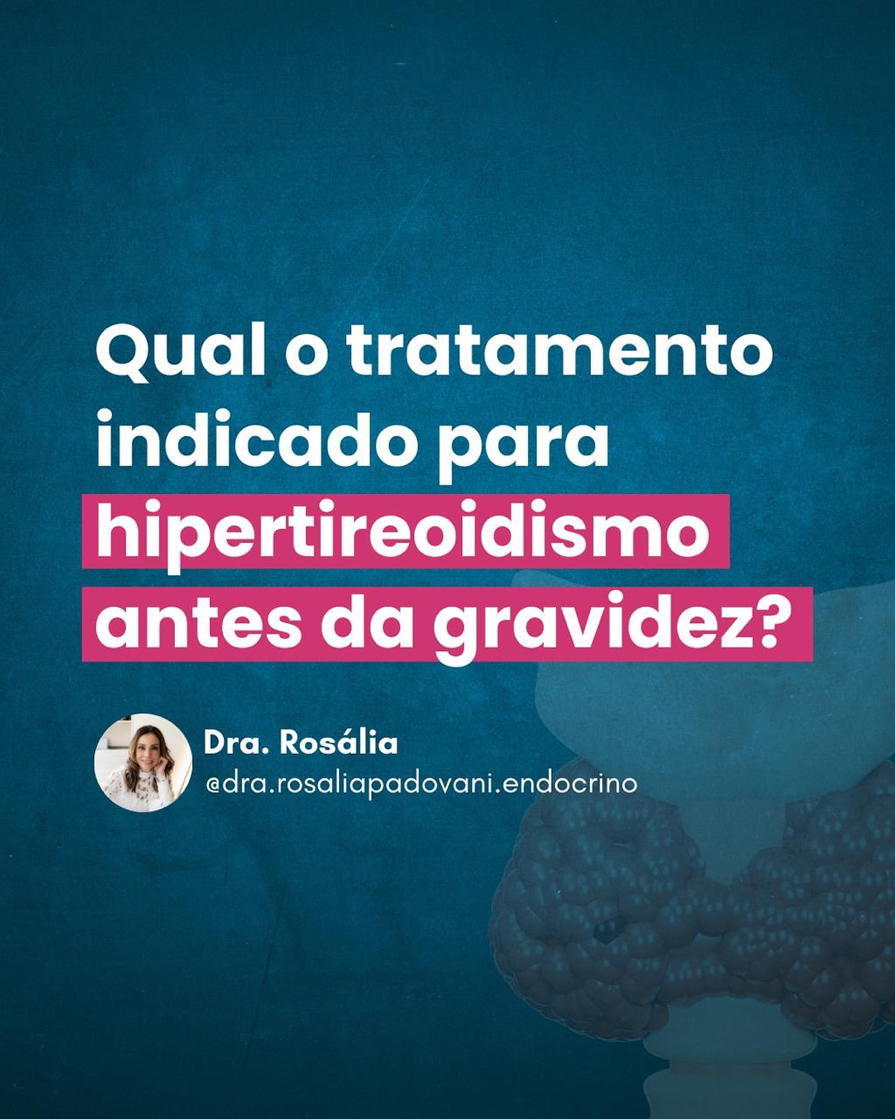 Leia mais sobre o artigo Qual o tratamento indicado para hipertireoidismo antes da gravidez?