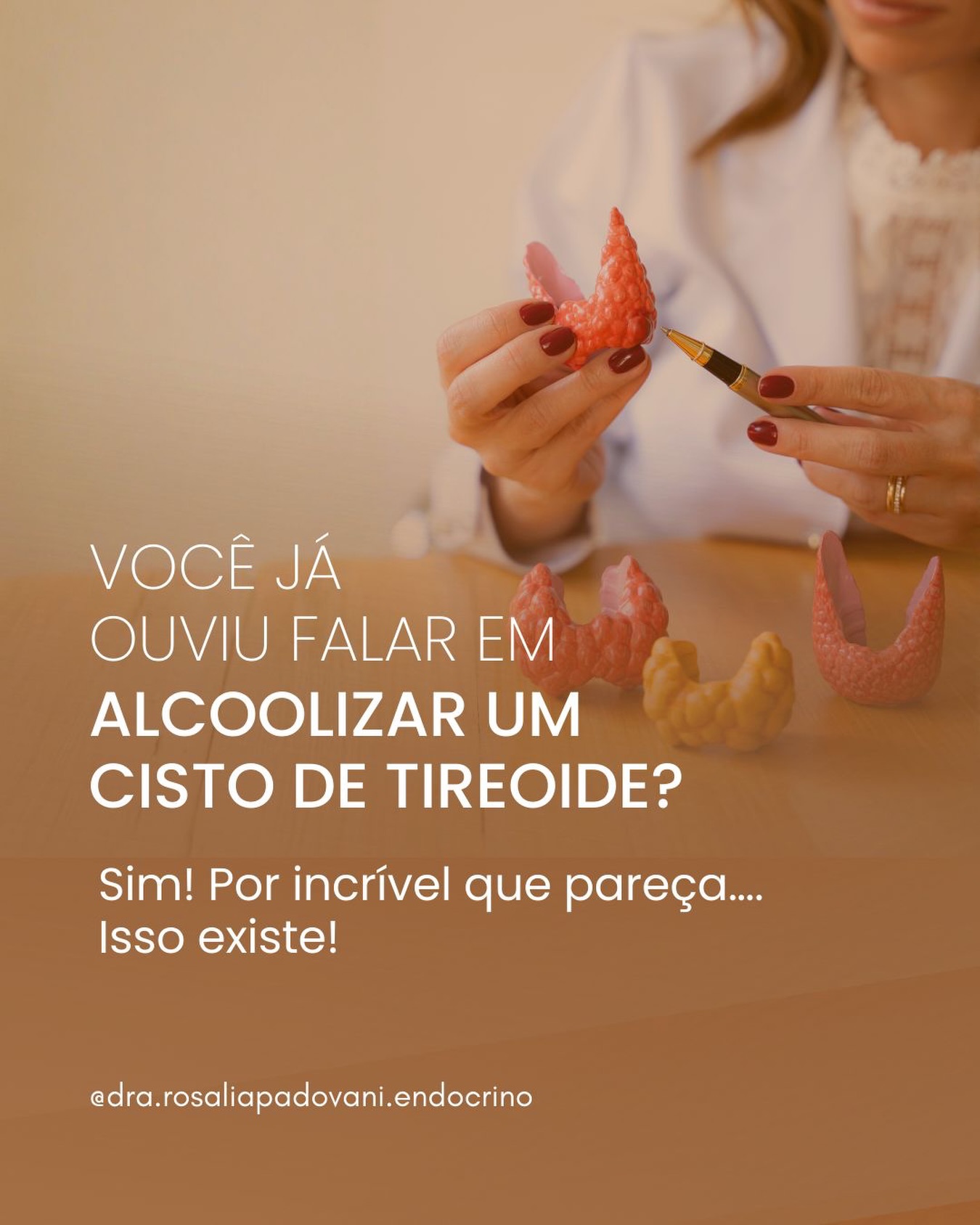 No momento, você está visualizando Você já ouviu falar em alcoolizar um cisto de tireoide?